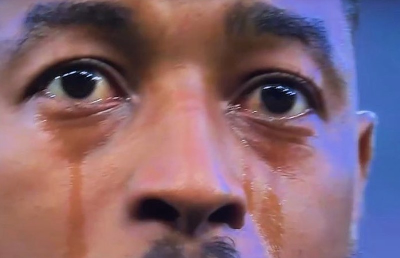 感言时当场, img, 比赛后